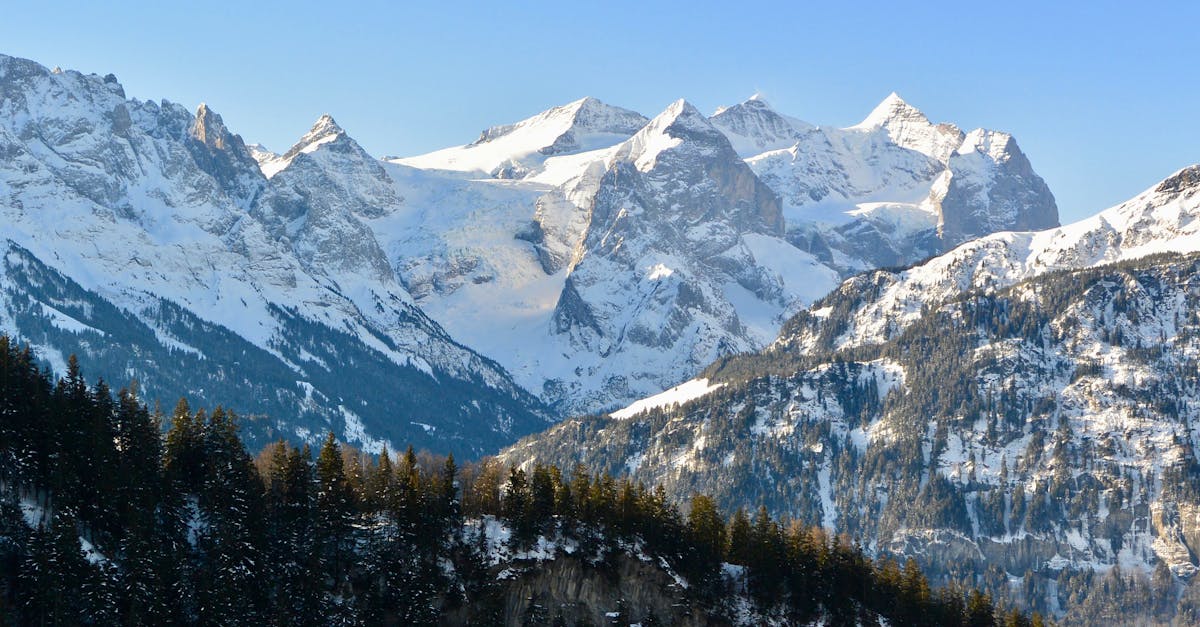 découvrez des traitements efficaces et des informations essentielles sur l'épaule gelée, une affection douloureuse qui limite les mouvements et la flexibilité. découvrez les symptômes, les causes et les stratégies de récupération pour retrouver la pleine fonction et le confort de votre épaule.