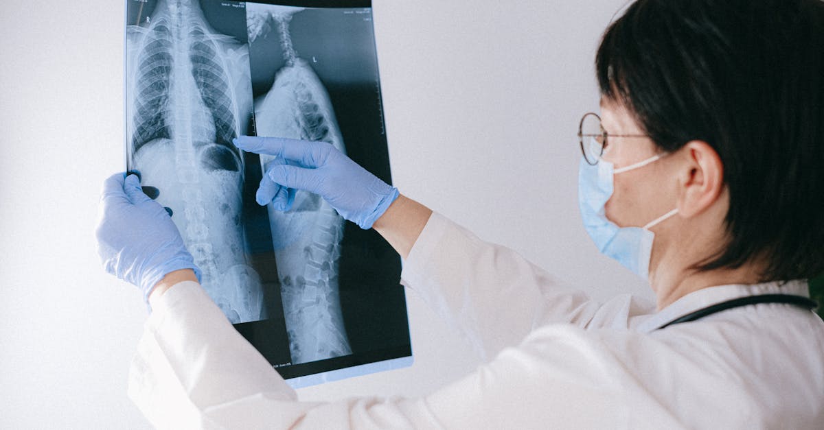 discover effective solutions and insights for managing thoracic spine pain, including causes, symptoms, treatment options, and prevention tips to improve your quality of life.