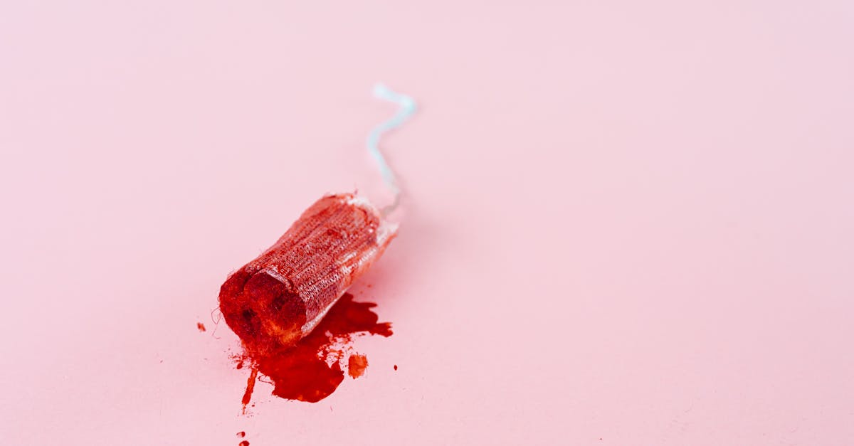 découvrez des stratégies et des traitements efficaces contre les migraines menstruelles. découvrez leurs causes, leurs symptômes et comment gérer la douleur pendant votre cycle menstruel.