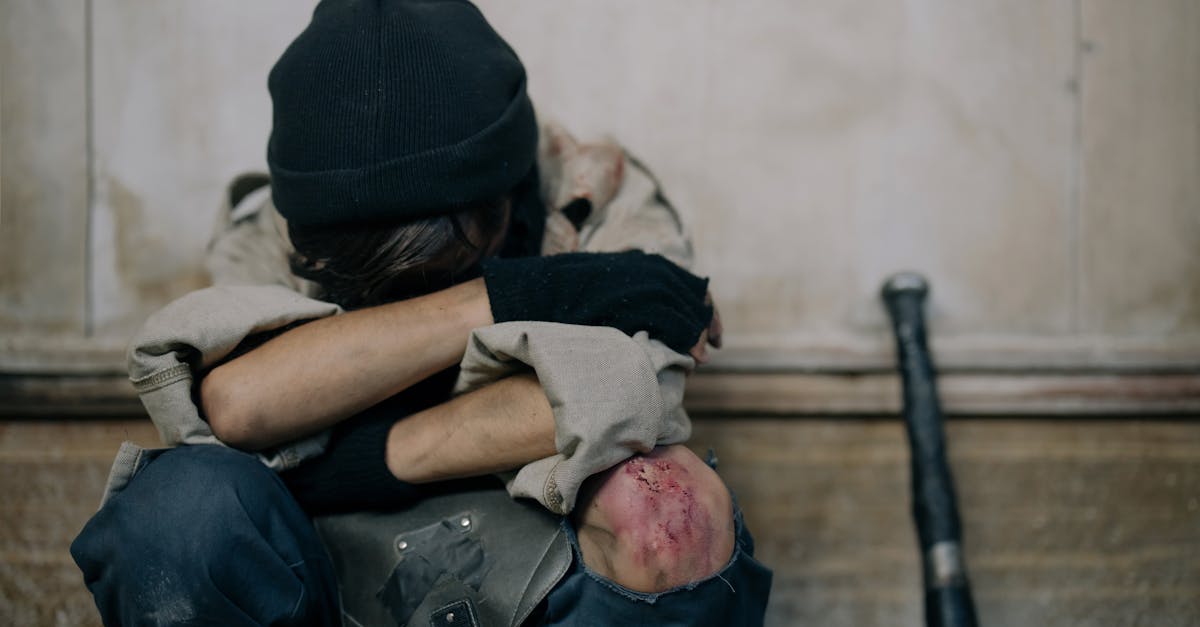 explore comprehensive insights into brachial plexus injuries, their causes, symptoms, and treatment options. learn how these injuries affect arm and shoulder function, and discover rehabilitation strategies to aid recovery.