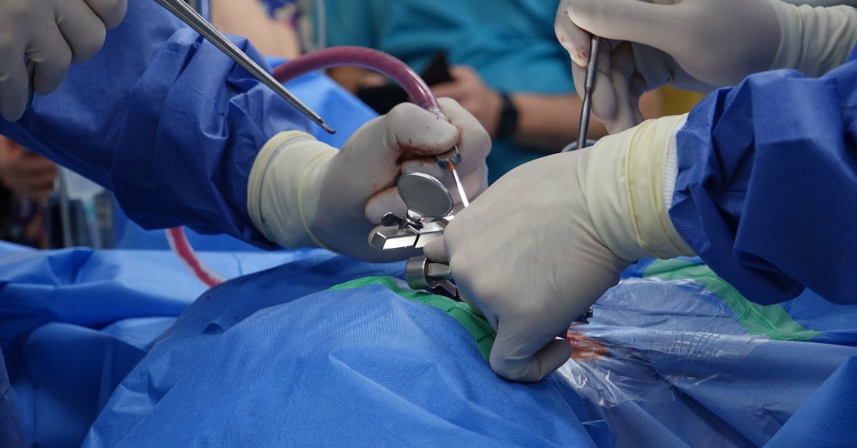 discover essential information about herniated discs, including symptoms, causes, treatment options, and prevention tips. learn how to manage pain and improve your mobility with expert advice.
