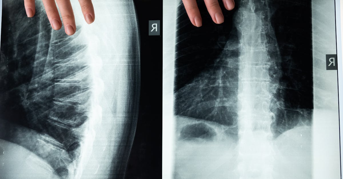 discover the benefits of lumbar support for improved posture and comfort. explore our range of lumbar products designed to alleviate back pain and enhance your sitting experience. perfect for home, office, or travel.
