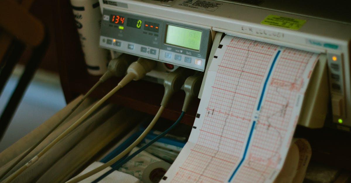 discover the innovative technique of pulse alignment, a cutting-edge method that enhances precision and accuracy in various applications. learn how pulse align technology can optimize your processes and improve outcomes across multiple industries.