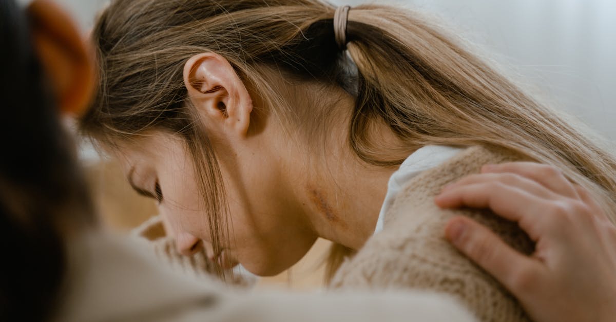 discover effective shoulder support solutions for pain relief and enhanced mobility. explore our range of adjustable, comfortable braces designed to stabilize and protect your shoulders during various activities. perfect for athletes, physical therapy, or everyday use.