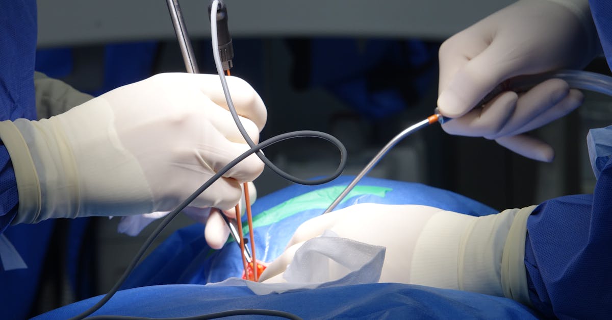 learn about spinal stenosis, a condition where the spinal canal narrows, leading to pressure on the nerves. discover symptoms, causes, treatment options, and lifestyle tips to manage this condition effectively.
