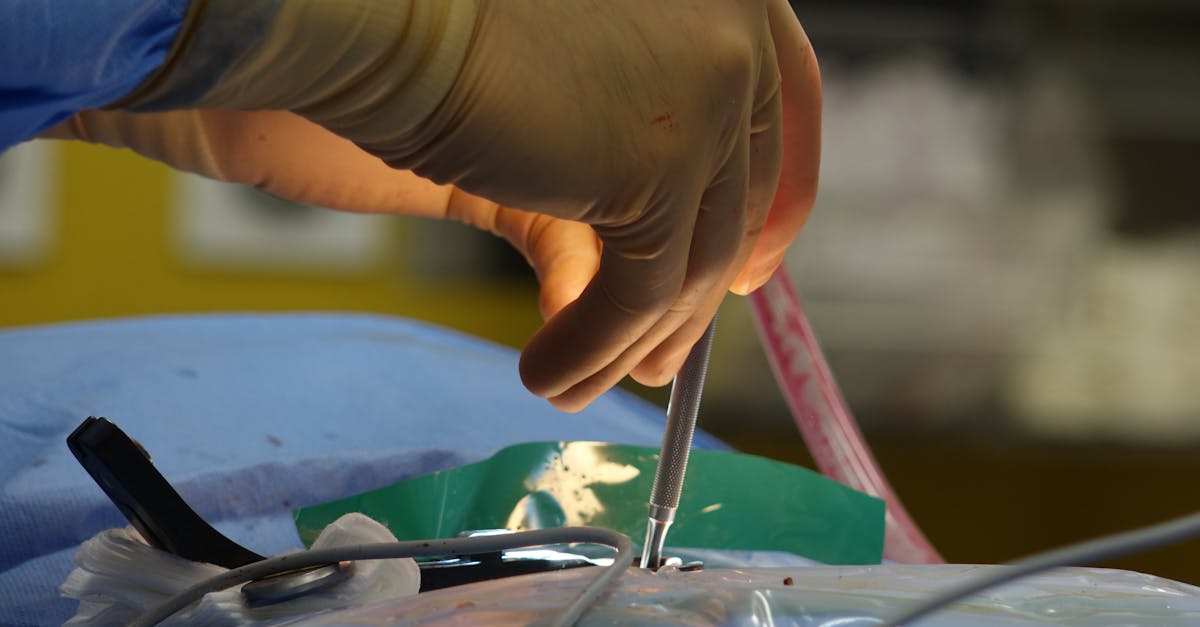 learn about herniated discs, their causes, symptoms, and treatment options. discover effective ways to manage pain and improve your spinal health.