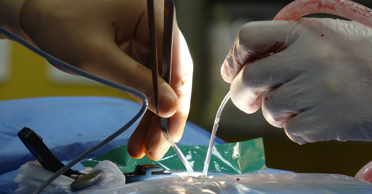 learn about herniated discs, their causes, symptoms, and treatment options. find effective relief strategies and expert insights to manage pain and improve your quality of life.