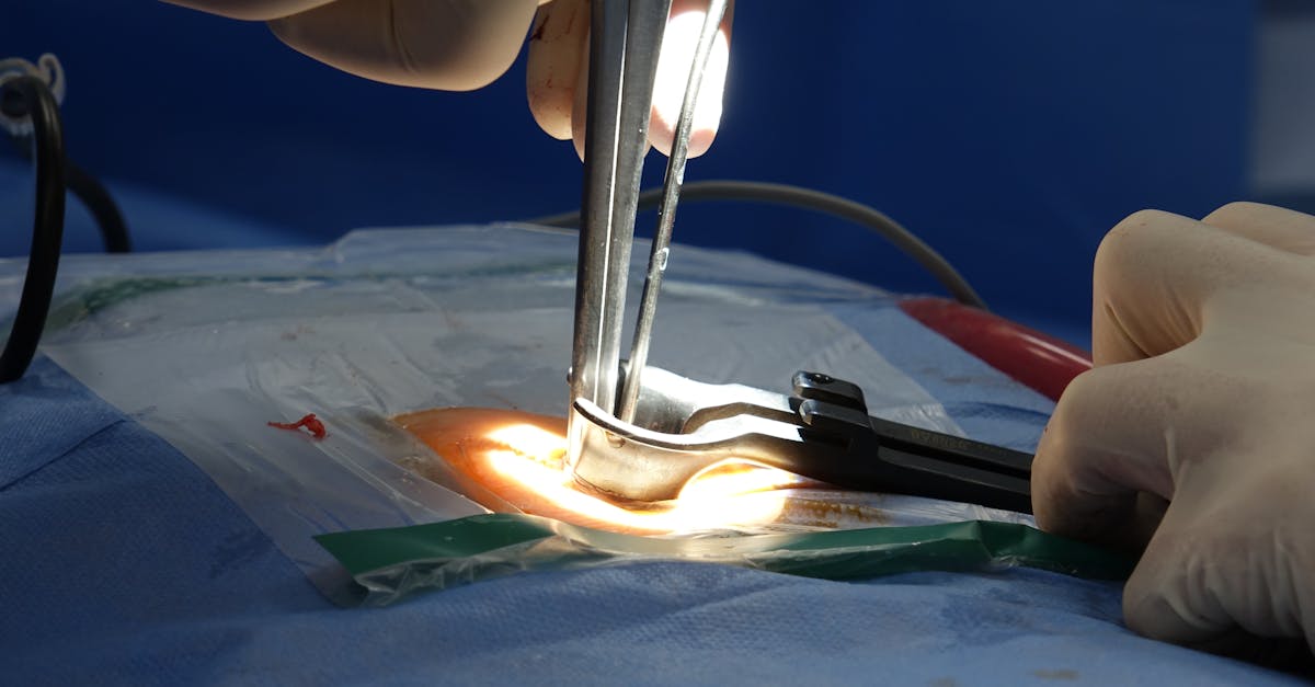 discover the causes, symptoms, and treatment options for a herniated disc. learn how to manage pain and improve mobility with effective strategies and expert advice.