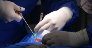 discover essential insights into spinal stenosis, a condition characterized by the narrowing of the spinal canal. learn about its causes, symptoms, and effective treatment options to manage pain and improve mobility.